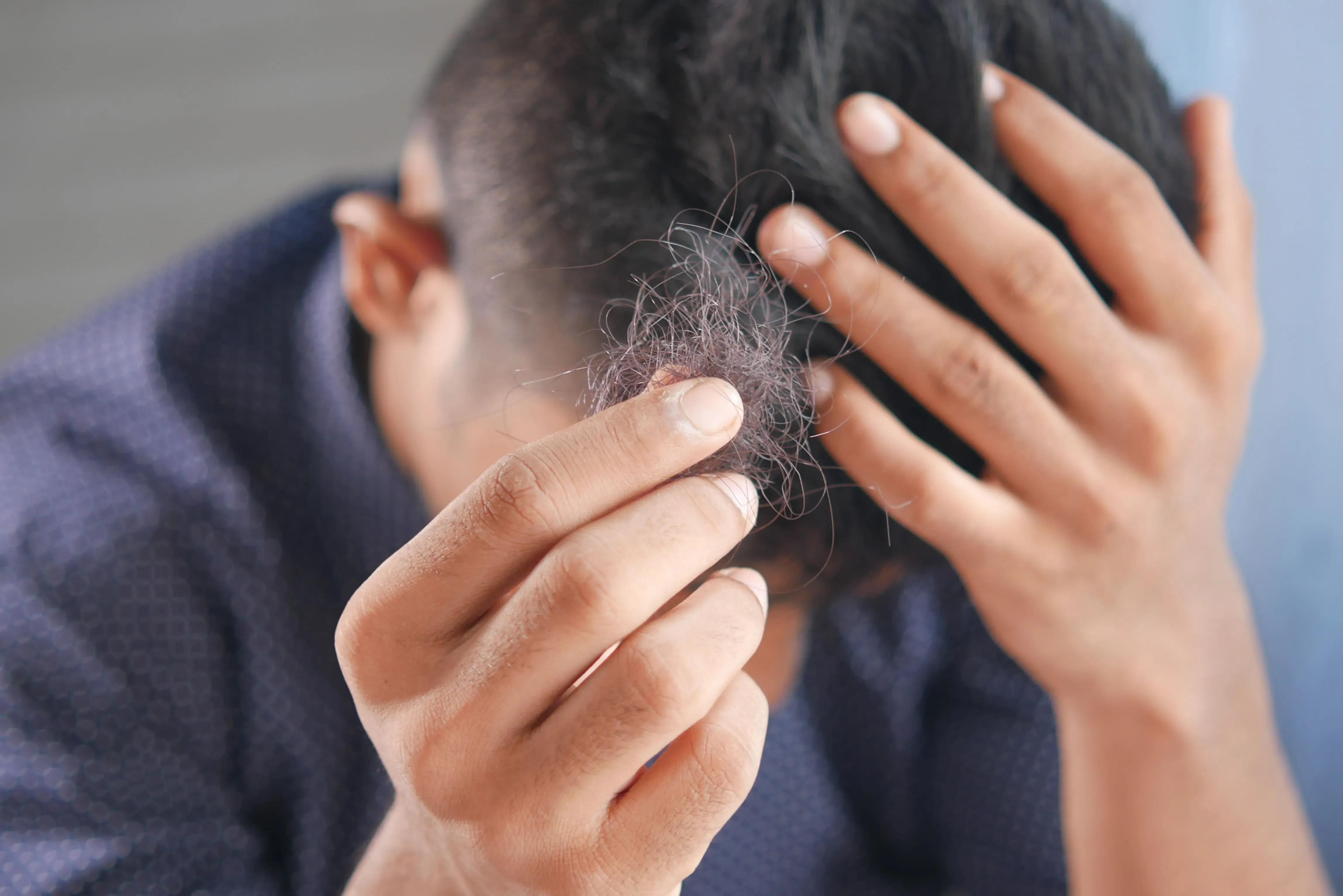 ¿Por qué se me cae el cabello?