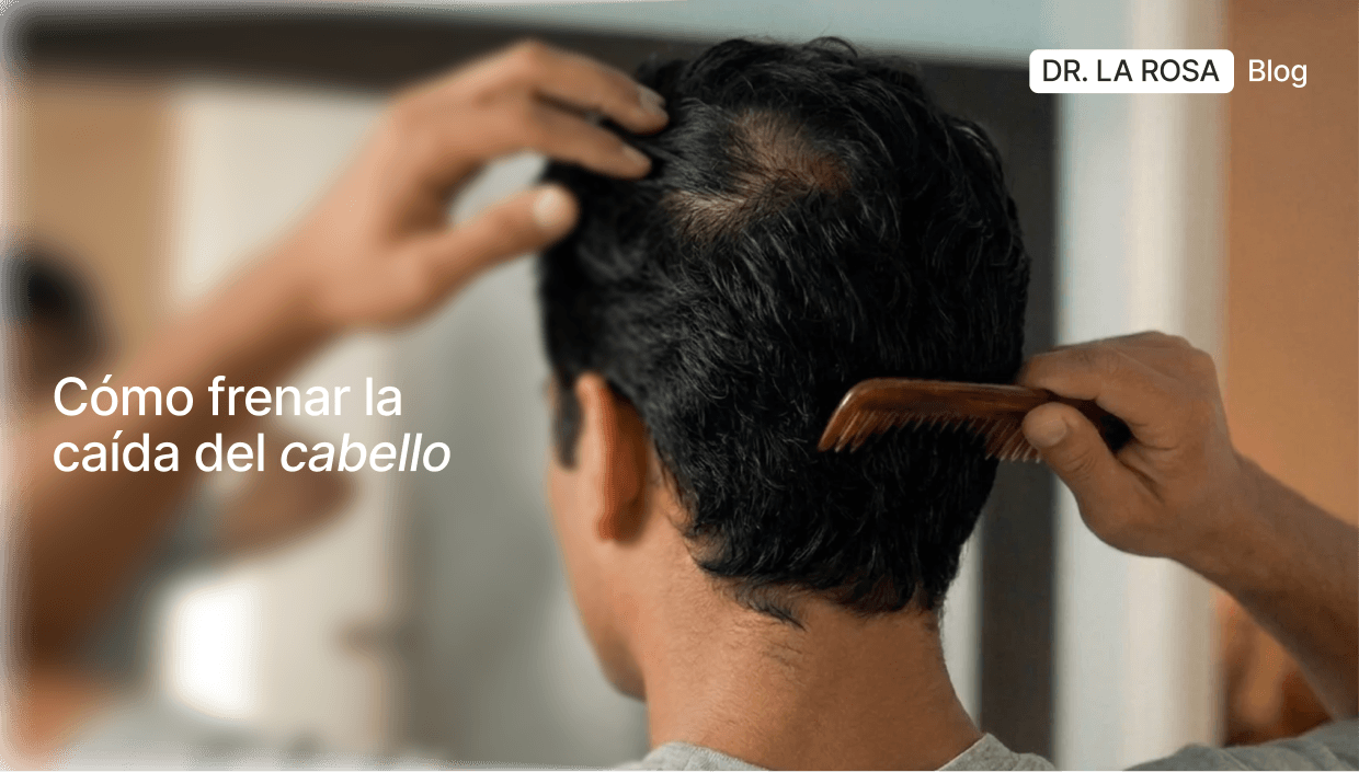 Guía completa para frenar la caída del cabello